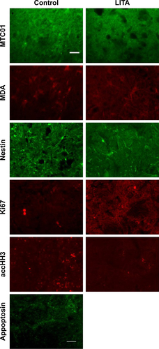 Figure S3 Immunofluorescence for mitochondrial density (MTCO1), lipid peroxidation (malondialdehyde, MDA), neural progenitors (nestin), proliferation (Ki67), histone H3 acetylation (accHH3), and appoptosis (appoptosin) in control or liposomal encapsulated acetate (LITA)-treated animals at 2 weeks after middle-cerebral artery occlusion.Note: Scale bar: 50 micrometer.