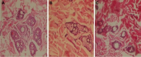 Figure 2 Microscopic view of three high power fields: control (A), formic acid (B), and sodium formate (C).