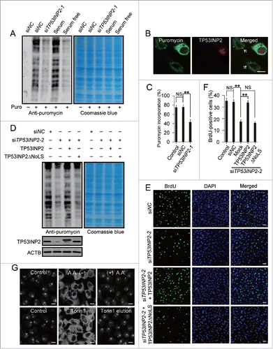 Figure 6. TP53INP2 is required for protein synthesis and cell proliferation. (A) Global protein synthesis detected by SUnSET in HeLa cells. The cells were either cultured with serum-free medium for 12 h or treated with TP53INP2 siRNA1. The specificity of the anti-puromycin antibody was demonstrated by a sample without puromycin incubation. Coomassie blue staining was used as loading control. (B and C) Puromycin incorporation in TP53INP2 siRNA1-treated cells detected by anti-puromycin antibody. Arrows indicate TP53INP2 knockdown cells. Scale bar: 10 μm. (D) HeLa cells treated with TP53INP2 siRNA2 for 24 h were transfected with TP53INP2-MYC or TP53INP2ΔNoLS-MYC. After 24 h, the nascent proteins were analyzed by SUnSET. (E and F) HeLa cells treated with TP53INP2 siRNA2 for 24 h were transfected with TP53INP2-MYC or TP53INP2ΔNoLS-MYC. After 24 h, cells were subjected to BrdU incorporation assay. Scale bar: 50 μm. (G) Intracellular distribution of TP53INP2 in HeLa cells. The cells were either cultured in amino acid-free medium for 3 h with or without replacement to normal medium for 3 h, or treated with 250 nM of Torin1 for 3 h with or without replacement to Torin1-free medium for 3 h. Scale bars: 10 μm. All the quantitative data are presented as mean ± SEM of triplicate experiments. **, P< 0.01; NS, not significant.