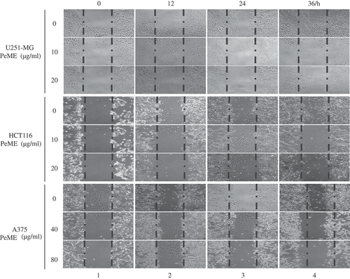 Figure 2. P. elegans methanolic extract (PeME) treatment showed the anti-metastatic effect and reduced the cell migration rate of the U251-MG, HCT116, and A375 cells. Wound closure ability of control and treated U251-MG (10 and 20 µg/ml), HCT116 (10 and 20 µg/ml), and A375 cells (40 and 80 µg/ml) were shown. The image of wounded wells was captured with the help of an inverted phase-contrast microscope at 0, 12, 24, 36 h (100x magnification).