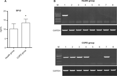 Figure 4 (A) The surfactant protein D (SP-D) serum levels of COPD patients and healthy control (*P<0.05, compared with the healthy group). (B) The HLA-A gene frequency in the blood samples of eight healthy controls (1/8, 12.5%) and eight COPD patients (5/8, 62.5%).
