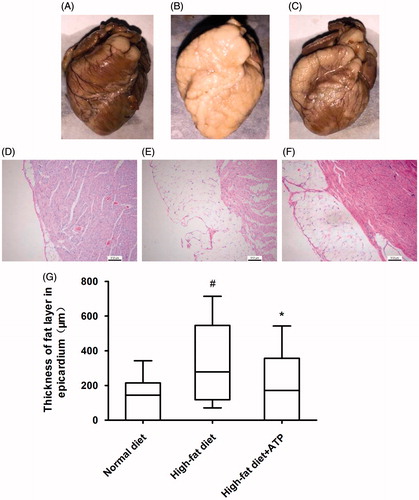 Figure 1. Macroscopic and histological photographs of rabbit hearts. Compared to a normal diet rabbit (A and D), high-fat diet animal (B and E) exhibited excessive fat deposition in epicardium; ATP supplementation rabbit (C and F) reduced the fat deposition. The measurement for the thickness of fat layer in epicardium displayed a significant decrease in ATP supplementation rabbit compared to high-fat diet animals (G). #p < 0.05 versus normal diet; *p < 0.05 versus high-fat diet. N = 8.