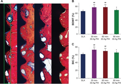 Figure 7 Histological observations and histomorphometric measurements.Notes: Histological sections stained with van Gieson’s picro fuchsin, from left to right, SLA group, 30 min-30 Ag PIII, 60 min-30 Ag PIII, 90 min-30 Ag PIII (A); The area of interest for the analysis of bone density within the threads (A, the green rectangle area); The BDWT and BIC of the bone volume adjacent to the implant surface were quantified (B and C); *P<0.01 versus the control SLA group; **P<0.05 versus the control SLA group; ##P<0.01 versus the 90 min-30 Ag PIII group.Abbreviations: Ag-PIII, silver plasma immersion ion implantation; BDWT, bone density within the threads; BIC, bone to implant contact; SLA, titanium surfaces treated by sandblasting with large grit and acid etching procedure; 30 min-30 Ag PIII, titanium surfaces treated by first SLA procedure and then silver plasma immersion ion implantation at 30 kV for 30 minutes; 60 min-30 Ag PIII, titanium surfaces treated by first SLA procedure and then silver plasma immersion ion implantation at 30 kV for 60 minutes; 90 min-30 Ag PIII, titanium surfaces treated by first SLA procedure and then silver plasma immersion ion implantation at 30 kV for 90 minutes.