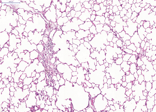 Figure 3.  Slight (multi)focal interstitial fibrosis and inflammatory cell infiltration after repeated intratracheal instillation of ultrafine amorphous SiO2 (Aerosil®150). H&E × 50.