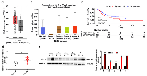 Figure 1. ISLR was up-regulated expression in gastric cancer. (a) The TCGA-STAD datasets indicated ISLR expression in GC tumor tissues was higher compared with that in normal tissues. (b) The ISLR expression in normal tissues and stage 1/2/3/4 of STAD. (c) As Kaplan–Meier survival plots shown, the higher ISLR abundance had relation to a poorer overall survival. (d) The mRNA expression of ISLR in tumor tissues and adjacent normal tissues of 27 patients with gastric cancer was detected using qRT-PCR. (e) Western blotting was used to detect the protein expression of ISLR in tumor tissues and adjacent normal tissues from 5 patients with gastric cancer. **P < 0.01, compared with normal tissues. T, gastric cancer tissue; N, adjacent normal tissues.