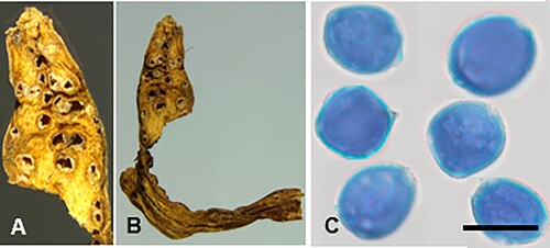 Figure 16. Puccinia liparophylli on Liparophyllum gunnii: A, B, Aecia. C, Aeciospores (in aniline blue). Scale bar = 20 μm.