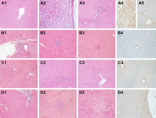 Figure 2 (A) Mtx group; 1: vacuolar degeneration in pericentral hepatocytes (H&E ×100), 2: an apoptotic hepatocyte (H&E ×100), 3: grade 2 portal inflammation (H&E ×100), 4: score 2 positive immunohistochemical staining with Bcl-2 antibody in hepatocytes of the lobular area and 5: pericentral zone (Bcl-2 antibody ×100). (B) Mol group; 1: granuloma formation in the portal area (H&E ×100), 2: mild bile duct proliferation (H&E ×100), 3: grade 1 portal inflammation (H&E ×100), 4: score 1 positive immunohistochemical staining with Bcl-2 antibody in hepatocytes of the pericentral zone (Bcl-2 antibody ×100). (C) Mol–Mtx group; 1: mild bile duct proliferation (H&E ×100), 2: grade 1 portal inflammation (H&E ×100), 3: minimal portal inflammation (H&E ×100), 4: score 1 positive immunohistochemical staining with Bcl-2 antibody in hepatocytes of the pericentral zone (Bcl-2 antibody ×100). (D) Mtx–Mol group; 1: moderate bile duct proliferation and grade 2 portal inflammation (H&E ×100), 2: granuloma formation in the lobular area (H&E ×100), 3: vacuolar degeneration in lobular hepatocytes (H&E ×100), 4: score 2 positive immunohistochemical staining with Bcl-2 antibodies in hepatocytes of the pericentral zone and lobular area (Bcl-2 antibody ×100).