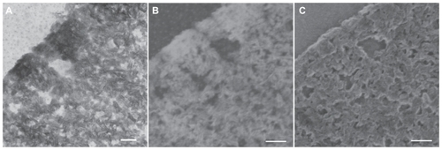 Figure 5 Representative electron microscopy images of a thin section (40 nm) near the surface of a microparticle by means of TEM (A), scanning dark-field (STEM DF, B) and scanning secondary electron (STEM SE, C) providing nanostructural aspects of SIBS. Thin platelets of HA are represented as dark platelet-shaped objects, perpendicular to the image plane, embedded in silica gel (A). A STEM DF image of the same region is presented (B). It represents the complementary image of (A). The position of the HA particles is more pronounced (white platelet-shaped objects) due to stronger scattering of HA compared with the silica gel. A STEM SE image of the same region is presented, showing the nanoporous structure of the silica gel matrix. Pores with pore sizes ranging from 10 nm to 100 nm in diameter are observable and are interconnected (C).Note: Scale bars: A, B, and C = 100 nm.Abbreviations: TEM, transmission electron microscopy; HA, hydroxyapatite.