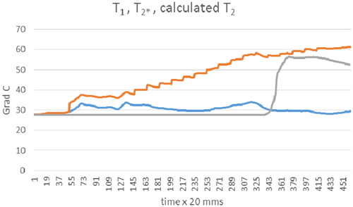 Figure 13. Т1 (Blue line), T2* (grey line), calculated T2 (orange line) during bicortical drilling as function of time.