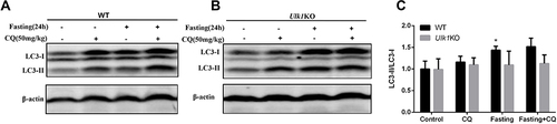 Figure 4 Comparison of basal and starvation-induced autophagy in liver of Ulk1KO and WT mice. Wild-type (A) and Ulk1KO (B) mice were treated as indicated, then lysates of liver were collected and subjected to immunoblotting to detect autophagic marker LC3. (C). Measurement of LC3-II/LC3-I band density ratio. *P < 0.05 vs control of WT mice.