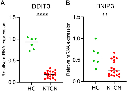 Figure 10 Quantitative real-time PCR results for hub genes in healthy controls (HC) and KTCN patients. (A) qRT-PCR result for DDIT3 in HC and KTCN patients. (B) qRT-PCR result for BNIP3 in HC and KTCN patients. **P < 0.01, ****P < 0.0001.
