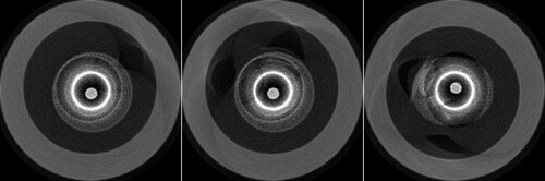 Figure 15. AOED images of three vessel phantoms obtained with the proposed method and the DC method.