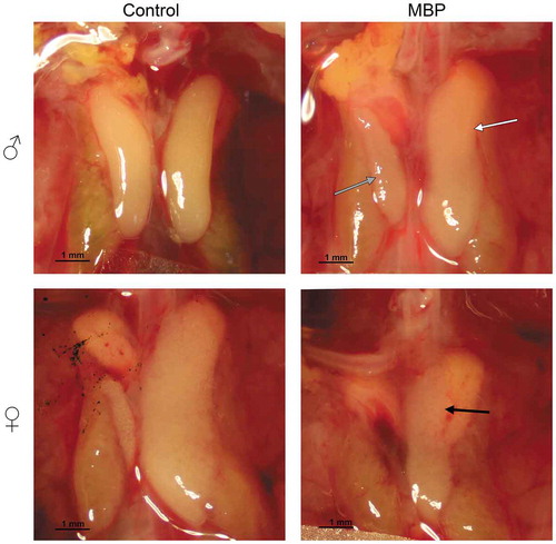 Figure 1. Representative images of male (♂) and female (♀) chicken gonads on embryonic day 19 after exposure to DMSO (control) or MBP (100 µg/g). The control embryos are shown in the left column and the MBP-exposed ones in the right. The right testicle (gray arrow) was smaller and the left testicle (white arrow) was larger in MBP-exposed males compared with those of control males. The left testicle in all MBP-exposed males was ovary-like in shape. The left ovary of the MBP-exposed females (black arrow) was smaller than in the control animals and appeared thin in some individuals, like the one in the image. The gonads of Mixture S-exposed females and males did not differ in appearance from those of control animals (not shown).