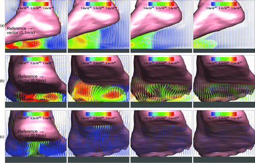 FIG. 10 Velocity fields (a) at a vertical plane (near the symmetry plane), (b) at a cross-sectional plane near the centerline of the foot, and (c) at a cross-sectional plane near the heel region for four different time instances. Colors represent the levels of particle concentrations (dp = 10 μm). (Color figure available online.)