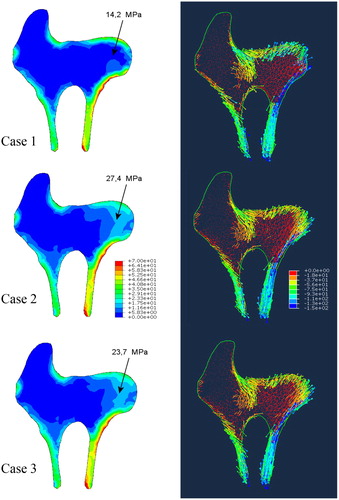 Figure 2. Predicted distributions of von Misses stresses and principle directions.