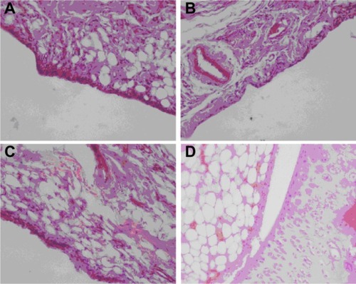 Figure 10 Histological evaluation of osteoarthritis model rabbits treated with (A) brucine-free bovine serum albumin nanoparticles, (B) brucine-loaded bovine serum albumin nanoparticles, (C) hyaluronic acid-coated brucine-loaded bovine serum albumin nanoparticles, and (D) physiological saline for 3 weeks (400× magnification).