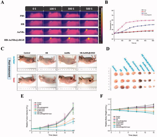 Figure 9. In vivo infrared thermal imaging and anti-tumor effect. (A) Infrared thermographic images of tumor-bearing mice under 660 nm laser irradiation for 0, 100, 300, and 500 s. Laser was irradiated at 12 h post i.v. injection of formulations. (B) Temperature variation curve at tumor sites after different treatment. (C) Representative photographs of ECA109 tumor-bearing mice from different groups during 15 days after treatment. (D) Photographs of sacrificed tumors from different groups during 15 days after treatment. (E) Tumor growth curves and (F) body weight change of ECA109 tumor-bearing mice from different groups during 15 days after treatment. Tumor volumes and body weight were normalized to their initial sizes and weight. Error bars represented the standard deviations of 6–8 mice per group, **p< .01 vs. control.