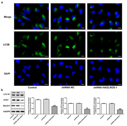 Figure 4. Impacts of HAGLROS silencing on the autophagy of HFWT cells. (a) Immunofluorescence staining was applied for exploring the level of LC3II in cells transfected with shRNA-HAGLROS-1 or shRNA-NC. Scale bar: 50 μm. (b) Protein levels of LC3II/I, ATG7 and Beclin1 in HAGLROS silenced cells by Western blot assay. **P < 0.01, ***P < 0.001 versus control.