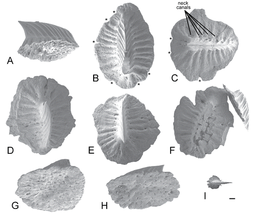 FIGURE 3. SEM images of detached large thorns (A–H) plus a single small denticle (I) from Tribodus limae AMNH FF13957. All views are of different denticles harvested from acid preparation residues. The original positions of these denticles on the body are unknown. A, presumed newly formed thorn denticle, in which the basal plate has not formed, but there is no pulp cavity; oblique lateral view, left side. B–F, mature thorn denticles in apical view (the crown has sheared off in F, revealing a radial arrangement of vascular canals). G, H, mature thorn denticles in oblique ventral view, showing the pitted basal plate. I, small ‘cock's comb’ denticle (also shown in H) for size comparison. Scale bar equals 100 µm.