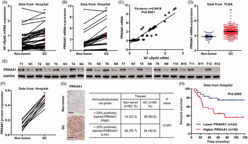 Figure 2. PRKAA1 is up-regulated in GC tissues. (A, B) NF-κBp50 and PRKAA1 mRNA expression in non-tumor gastric (n = 60) and GC tissues (n = 60) from Hospital data was measured. (C) Linear regression showed that the mRNA expression of NF-κBp50 was positively correlated with PRKAA1 mRNA expression in GC tissues (n = 60) from Hospital. (D) PRKAA1 mRNA expression in non-tumor gastric and GC tissues from TCGA database was measured. PRKAA1 protein expression in non-tumor gastric and GC tissues from Hospital data was measured by Western blot (E, F) and IHC (G) analysis, respectively. Scale bars: 100 μm. (H) Survival analysis of patients with GC. **p < .01 compared with non-tumor gastric tissues.