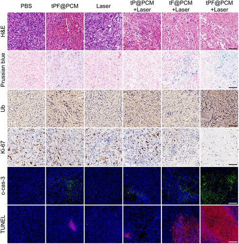 Figure 6 Histochemical images of xenografted 786-O tumor tissue sections at day 3 after laser irradiation. For cleaved caspase-3 (c-cas-3) and TUNEL immunofluorescence staining, nuclei were stained blue (DAPI staining) and apoptotic cells were stained green (c-cas-3 staining) or red (TUNEL staining). Scale bars represent 100 μm.