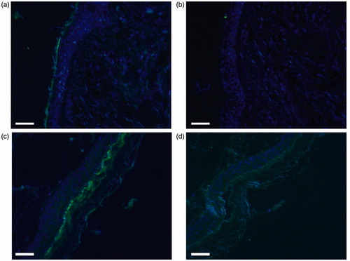 Figure 3. Photomicrographs of fluorescence immunohistochemical staining for TRPV4. The panels show positive staining/negative control pairs of the postauricular skin (a/b) and cholesteatoma tissue (c/d). Green and blue colors express the fluorescence of Alexa Flour 488 and DAPI, respectively. There is weak fluorescence in the horny layer of both skin and cholesteatoma, whereas the underlying viable cell layers show no fluorescence in either tissue. Scale bar = 50 μm.