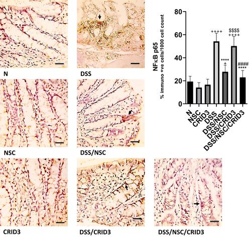 Figure 5 Immunostaining of NF-κB. Photomicrographs of specimens from: (N), (NSC), and (CRID3) show scanty NF-κB p65 expression; (DSS), shows marked expression of NF-κB P65 in the damaged crypts and inflammatory cells, such as polymorphonuclear leukocytes and monocytes (filled arrow); (DSS/NSC), shows moderate decrease in the NF-κB P65 expression (filled arrow); (DSS/CRID3), shows increased expression of NF-κB P65 (filled arrow); (DSS/NSC/CRID3), shows marked reduction in the NF-κB P65 expression in the epithelia of glands and crypts (filled arrow). As shown in NF-κB p65 immunoreactivity evaluation figure, a significant decrease in the percentage of NF-κB P65 immunopositive cells/1000 counted cells was detected in rats treated with DSS/NSC and DSS/NSC/CRID3 compared with the untreated DSS rats. The insignificant change in the percentage of NF-κB P65 immunopositive cells/1000 counted cells was observed in rats treated with CRID3. NF-κB p65 IHC, bar = 50 µm. +P < 0.05 vs N, ++++ P < 0.0001 vs N, ****P < 0.0001 vs DSS, ####P < 0.0001 vs DSS/CRID3, $$$$P < 0.0001 DSS/CRID3 vs DSS/NSC.