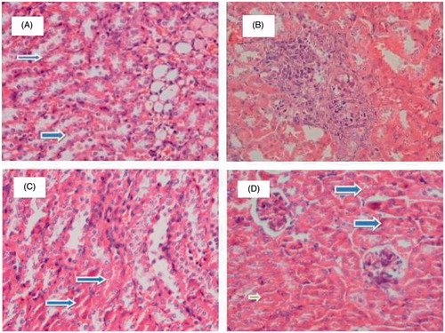 Figure 2. Histological examination of mice treated with cisplatin and/or thymol. The kidney of control mouse shows normal tubule (A). Kidney of mice administered with cisplatin at a single dose of 7.5 mg/kg exhibited a distinct histological difference when compared with control, these kidney shows large numbers of tubules with degeneration (B). Mild improvement in tubular degeneration was seen in mice treated with thymol at dose 50 mg/kg and cisplatin (C). Minimal tubular degeneration in mice treated with thymol at dose 150 mg/kg and cisplatin (D). Blue arrow shows normal tubules and green arrows shows tubular degeneration.