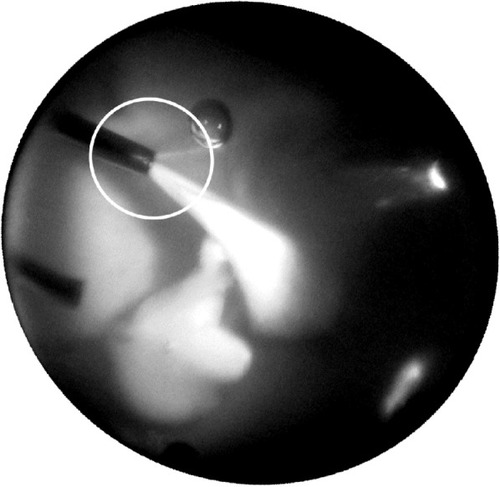 Figure 5 Intraoperative image of a rabbit cadaver eye.