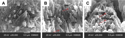 Figure 6 SEM of a male Schistosoma mansoni worm (×35,000) recovered from a mouse treated with (A) PZQ suspension, (B) PZQ–LNC-25 or (C) PZQ–OA–MFS–LNC-25 showing nanostructures of similar size to LNCs in between spines and on damaged schistosomal surface (indicated by arrows), only in worms recovered from mice treated with PZQ–LNC formulations (B and C).Abbreviations: LNCs, lipid nanocapsules; MFS, miltefosine; OA, oleic acid; PZQ, praziquantel; SEM, scanning electron microscopy.