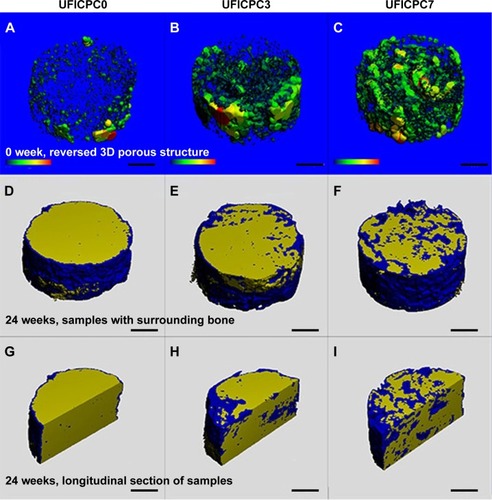 Figure 10 3D micro-CT reconstruction and 3D longitudinal section models before and after implantation.Notes: 3D micro-CT reconstruction models of the reversed 3D porous structure without CPC matrix before implantation (A–C). UFICPC3 and UFICPC7 exhibited more and larger pore volume and interconnected channel-like pores throughout the shell and core. Also shown are 3D micro-CT reconstruction models of cements after implantation for 24 weeks (D–F) and 3D longitudinal section models of cements after implantation for 24 weeks (G–I). The pristine CPC degradation was slow and the bone regeneration was limited to the peripheral area (D, G). On the other hand, the cement bodies of UFICPC3 (E, H) and UFICPC7 (F, I) were fragmented, and the new bone (blue color) occupied both on the outer surface and within their body. Bar: 1 mm.Abbreviations: CPC, calcium phosphate cement; CT, computed tomography; UFICPC, ultrafine fiber-incorporated CPC; 3D, three dimensional.