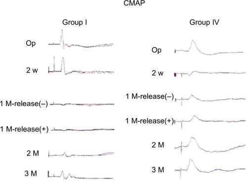 Figure 2 Representative compression–decompression CMAP tracings in the STZ-induced diabetic rats (group I) and nondiabetic rats (group IV). Note that the amplitude improved in both groups but was more significant in group IV.