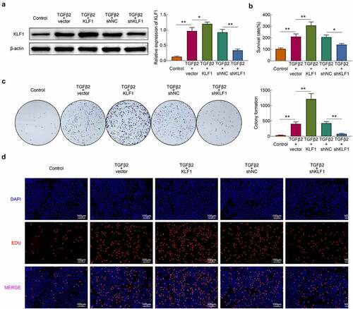 Figure 2. KLF1 enhanced the proliferation of human lens epithelial cells. (a) The expression of KLF1 in human lens epithelial cells determined by western blotting. (b) The survival rate of human lens epithelial cells detected by CCK-8 assay. (c) The proliferation of human lens epithelial cells detected by clone formation assay . (d) The proliferation of human lens epithelial cells determined by EdU assays. * p < 0.05, ** p < 0.01, *** p < 0.001