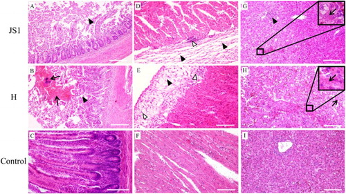 Figure 6. Microscopic lesions in 12-day-old goslings which died from infection with the JS1 and H isolates of GPV. Top panel, JS1-infected group; middle panel, H-infected group; bottom panel, uninfected control group. (A and B) Duodenum with haemorrhages (black arrow), villi missing, degeneration, and necrosis of epithelial cells (solid triangle). (C) Small intestine from an uninfected gosling. (D and E) Heart with thickened epicardium (solid triangle), infiltration of lymphocytes (open triangle). (F) Heart from an uninfected gosling. (G and H) Liver with degeneration and necrosis of hepatocytes (black arrow), and infiltration of lymphocytes (solid triangle). (I) Liver from an uninfected gosling.