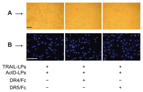 Figure 6 Qualitative assessment of apoptosis induced by TRAIL liposomes, ActD liposomes or both agents. (A) Bar = 250 μm. (B) Bar = 250 μm.Abbreviations: TRAIL, tumor necrosis factor-related apoptosis-inducing ligand; ActD, actinomycin D; LPs, liposomes.