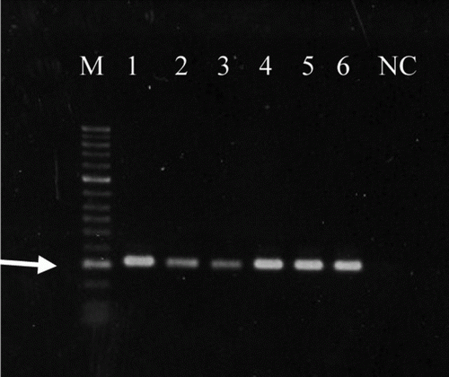 Figure 2.  M. iowae PCR result with the six M. iowae serotypes. M, marker (arrow indicates 300 base pairs); lane 1, M. iowae 695 (serotype I); lane 2, M. iowae DJA (serotype J); lane 3, M. iowae DK-CPA (serotype K); lane 4, M. iowae FMN (serotype N); lane 5, M. iowae L3-10B (serotype Q); lane 6, M. iowae DRA-0 (serotype R); NC, negative control.