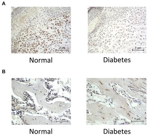 Figure 3 Expression of FGF-2 in osteotylus. (A) Immunohistochemical results showing the expression of FGF-2 in PMF area of osteotylus. The representative pictures of the cells containing FGF-2 were shown. (B) Immunohistochemical results showing the expression of FGF-2 in MCF area of osteotylus. The representative pictures of the cells containing TNF-α were shown. The brown color in both (A) and (B) Indicated the level of FGF-2, the deeper brown color of the cell, the higher level of FGF-2 in the cell.