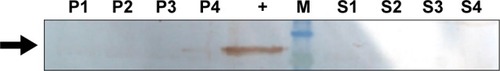 Figure 7 Western blot analysis of bisphosphoglycerate mutase. P1–P4 show four representative samples from Parkinson’s disease group; S1–S4 show four representative samples from schizophrenia group. +, Positive control; M, marker.