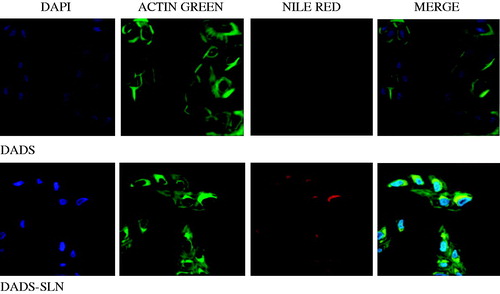 Figure 9. Confocal microscopic images of free Nile Red and SLN. Images taken after 2 h of treatment and stained with ER-Tracker™ Green (green for endosplamic reticulum) and DAPI (blue for nucleus). Nile Red represents red color. The overlap of ER-Tracker™ Green and Nile Red is visualized as yellow-color spots. (For color images refer online version).