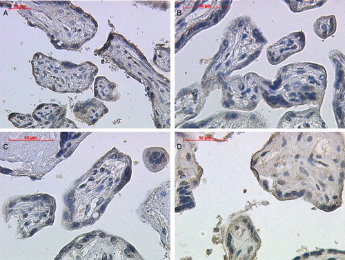 Figure 1. Immunohistochemical staining reaction of inhibin-βC in placental syncytiotrophoblast cells. Syncytiotrophoblast cells demonstrated a positive cytoplasmatic staining intensity for inhibin-βC antibody in normal ( A; lens 20, top left panel), preeclamptic ( B; lens 40, top right panel), HELLP (C; lens 40, lower left panel), and IUGR (D; lens 40, lower right panel) placental tissue.