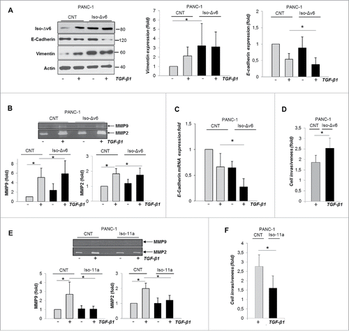 Figure 7. The gain of Iso-Δv6 isoform in the absence of Iso-11a increases vimentin expression and is essential for TGF-β1-induced PDAC cell invasiveness. Representative WB (left) and quantitative analysis of vimentin and E-cadherin expression in PANC-1 cells transfected with hMENAΔv6 compared with control cells (CNT), untreated or TGF-β1-treated (48 h); (B) Gelatine zymography on CM of control and Iso-Δv6 transfected cells, pre-treated or not with TGF-β1 (24 h). MMP2 and MMP9 quantification is shown as the mean ± SD of three independent experiments.*p ≤ 0.05. (C) qRT-PCR analysis of E-cadherin expression in control and Iso-Δv6 transfected PANC-1 cells. (D) Matrigel invasion assays of CNT and Iso-Δv6 PANC-1 cells untreated or TGF-β1-treated (24 h). Histograms represent the increase of TGF-β1-mediated cell invasiveness. (E) Gelatine zymography of CM from PANC-1/CNT and PANC1/ Iso-11a cells, untreated or TGF-β1-treated (24 h). MMP2 and MMP9 quantification is shown. (F) Matrigel invasion assays of PANC-1/CNT and PANC-1/ Iso-11a cells, untreated or TGF-β1-treated (24 h). Histograms represent the increase of TGF-β1-mediated cell invasiveness. Data are mean ± SD of three independent experiments. *p ≤ 0.05.