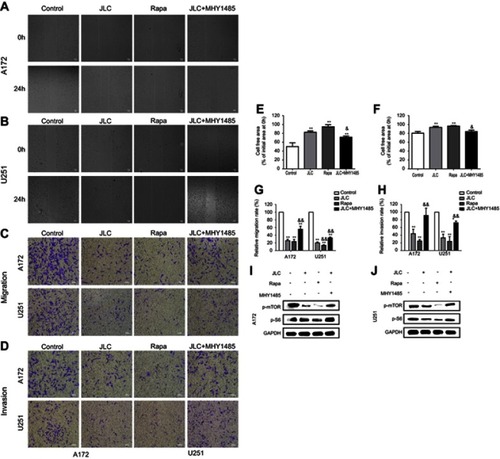 Figure 5 Effects of rapamycin and MHY1485 on the invasion and migration of A172 and U251 cells. (A) Representative images of wound closures in A172 cells. (B) Representative images of wound closures in U251 cells. (C) Representative images of migration in A172 and U251 cells. (D) Representative images of invasion in A172 and U251 cells. (E) Statistical analysis of cell-free area for A172 cells. (F) Statistical analysis of cell-free area for U251 cells. (G) Statistical analysis of relative migration rate. (H) Statistical analysis of relative invasion rate. (I) Representative blot of A172 and U251 cell lysates. All experiments were performed in triplicates. Significant difference from control group, *P<0.05 and **P<0.01. Significant difference from JLC group, &P<0.05 and &&P<0.01. Magnification, 40×.