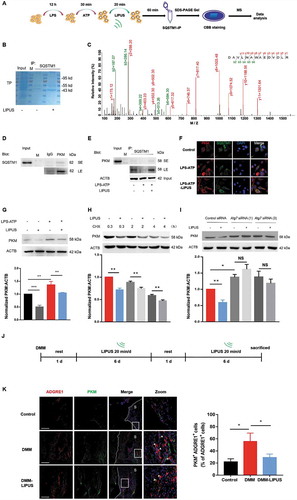 Figure 7. LIPUS accelerates the formation of SQSTM1-PKM complex and promotes the degradation of PKM in an autophagy-dependent way. (A) THP-1 cells were stimulated with LPS for 12 h and ATP for 30 min. Then, the cells were treated with or without LIPUS for 20 min. Sixty min later, the cells were harvested for immunoprecipitation (IP) with SQSTM1. Then, the immunoprecipitates were subjected to SDS-PAGE gel and stained with Coomassie Brilliant Blue (CBB). Subsequently, the gel was cut and subjected to mass spectrometry analysis. (B) CBB staining for SQSTM1-immunoprecipitates in SDS-PAGE gel. (C) The mass spectrum of peptides for PKM is shown. (D) THP-1 cell lysates were immunoprecipitated with anti-PKM antibodies and subsequently immunoblotted with anti-SQSTM1 antibodies. (E) THP-1 cells were exposed to LPS for 12 h and ATP for 30 min. Subsequently, LIPUS treated cells for 20 min. Sixty min later, whole cell lysates were collected for immunoprecipitation with anti-SQSTM1 antibody and immunoblotted with anti-PKM antibody. (F) Immunostaining detection for PKM (red) and SQSTM1 (green) in LPS-ATP or LPS-ATP-LIPUS-treated THP-1 cells. Scale bars: 20 μm. (G) After THP-1 cells were treated with or without LPS-ATP and LIPUS, the lysates were obtained for western blotting assays with anti-PKM antibodies. Statistical analysis was performed using two-way ANOVA followed by Bonferroni’s multiple comparisons test. NS, not significant, **p < 0.01, ***p < 0.001. (H) The LPS-ATP-treated cells were treated with 5 μM CHX combined with or without LIPUS at indicated intervals. PKM expression was analyzed by western blotting. Statistical analyses were performed using Student’s t test. **p < 0.01. (I) ATG7 siRNA (1) and (3) were transfected into THP-1 cells for 24 h to knockdown ATG7 and then the cells were treated with LPS-ATP followed with or without LIPUS. PKM level was examined by immunoblotting. Statistical analyses were performed using Student’s t test. NS, not significant, *p < 0.05, **p < 0.01. (J) Illustration of the procedure of LIPUS treatment in DMM model. (K) The sections from right knee joint of mice were immunostained with anti-ADGRE1 (red) and anti-PKM (green) antibodies. Nuclei were stained by DAPI (blue). The white arrows refer to PKM+ macrophages. Scale bars: Scale bars: 200 μm. The percentage of PKM-positive macrophages in total ADGRE1-positive macrophages in air pouch wall is presented in right panel. Statistical analyses were performed using two-way ANOVA followed by Bonferroni’s multiple comparisons test. *p < 0.05. The dotted lines represent the boundary of synovium. TP, total protein, M, marker, S, synovium.