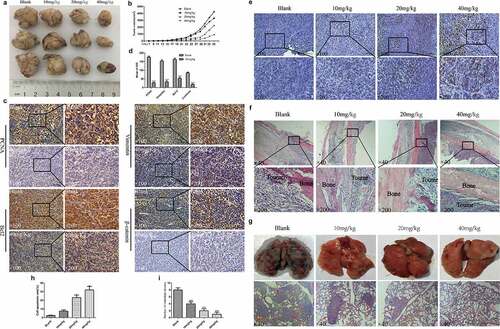 Figure 5. EGCG inhibits OS growth in vivo. (a, b) Macroscopic view of recovered tumor tissues and graph showing tumor growth. (c, d) The expression of PCNA, vimentin, Bcl-2 and β-catenin in tumor tissues was detected by IHC. Magnification, ×100 and ×200. (e, h) Detection of apoptosis in tumor tissue by Tunel assay. Magnification, ×100 and ×200. (f) H&E staining of bone tissue at the tumor cell injection site. Magnification, ×40 and ×200. (g, i) Macroscopic view of recovered lung tissue and H&E staining of tissue sections. The red arrow points to the tumor metastasis. Magnification, ×40. *p < 0.05, ** p < 0.01, and *** p < 0.001 vs. the blank group.