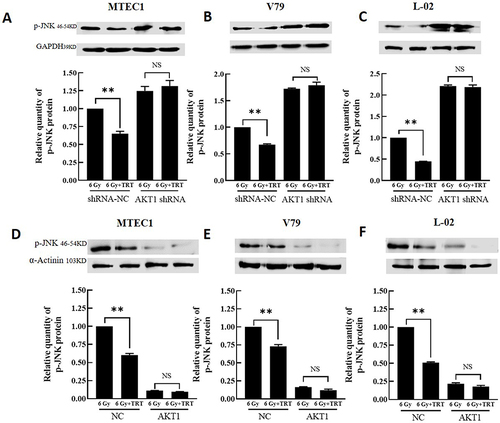 Figure 7 The impact of overexpressing or silencing AKT on the expression of p-JNK and total JNK. The p-JNK and JNK levels in MTEC1 (A and D), V79 (B and E), and L-02 (C and F) cells in the 6 Gy and 6 Gy+TRT groups were assessed by Western immunoblotting, and results were analyzed by GraphPad Prism 8. **P < 0.01.