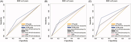 Figure 1. Time-dependent receiver operating characteristic (ROC) curves for OS at 3 years (A), 5 years (B) and 8 years (C) based on GPS, PNI, CP grade, and ALBI grade. ALBI: albumin–bilirubin; GPS: Glasgow prognostic score; PNI: prognostic nutritional index; CP: Child–Pugh. The time-dependent ROC curves and the corresponding estimated areas under the curve were used to compare the abilities of the variables to predict prognosis with respect to overall survival rates at different time points.