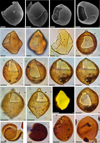 Plate 6. Pyxidinopsis? sp. 1 from the Vranović section, Našice, and its comparision to the Lake Pannon Tectatodinium pellitum specimens. All scale bars represent 10 µm except 15 where it is 20 µm. 1–4. Scanning electron microscope (SEM) micrographs of Pyxidinopsis? sp. 1 from Našice. All material is from SEM stub B2 housed at the Department of Botany, Hungarian Natural History Museum, Budapest, Hungary. Working distance 6.6 mm, acceleration voltage 15 kV. Note the large archeopyle in precingular position in figures 3–4. 5–6. Pyxidinopsis? sp. 1 specimen with sub-cruciform outline, apical and antapial notches in dorso-lateral view. Našice, sample B4, slide number 2, embedded in silicone oil. Specimen was rotated in silicone oil. 7. Pyxidinopsis? sp. 1 specimen in lateral view, Našice, sample B4, slide number 1, embedded in glycerine jelly. 8. Pyxidinopsis? sp. 1 specimen in dorso-apical view, Našice, sample B4, slide number 2, embedded in silicone oil. 9–10. Pyxidinopsis? sp. 1 specimen in dorsal (9) and dorso-apical (10) view, Našice, sample B4, slide number 2, embedded in silicone oil. Specimen was rotated in silicone oil. 11–12, 16. Pyxidinopsis? sp. 1 specimen in dorsal view, Našice, sample B4, slide number 2, embedded in silicone oil. Specimen was rotated in silicone oil. 13–14. Pyxidinopsis? sp. 1 specimen in dorso-lateral view, Našice, sample B5, slide number 2, embedded in silicone oil. 15. Pyxidinopsis? sp. 1 specimen in fluorescent light, lateral view, Našice, sample B5, slide number 2, embedded in silicone oil. 17–20. Lake Pannon Tectatodinium pellitum specimens from the Paks area (central Hungary). Note the differences in wall features between Pyxidinospis? sp. 1 and Tectatodinium pellitum. 17. Tectatodinium pellitum PAET 27, depth 189.1 m, slide number 1, embedded in glycerine jelly. 18. Tectatodinium pellitum specimen in lateral view, PAET 30, depth 492 m, slide number 1, embedded in glycerine jelly. 19. Tectatodinium pellitum specimen in dorso-lateral view, PAET 30, depth 477 m, slide number 1, embedded in glycerine jelly. 20. Tectatodinium pellitum, PAET 27, depth 375 m, slide number 1, embedded in glycerine jelly.