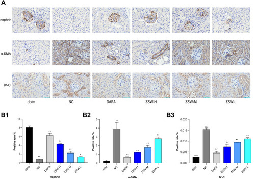 Figure 8 ZSW treatment regulates the major biomarkers of renal injuries in db/db mice. (A) Nephrin, α-SMA and IV-C expression detected by IHC analysis (400 ×); (B) The positive rate of the IHC results. Data are presented as mean ± SD (n = 3). **P < 0.01, vs db/m group; #P < 0.05, ##P < 0.01, vs NC group.