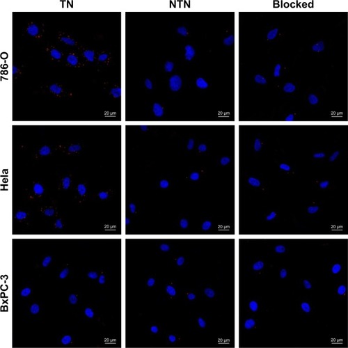 Figure 4 Binding ability of nanobubbles in vitro.Notes: The binding ability of nanobubbles to 786-O cells (upper), the binding ability of nanobubbles to Hela cells (middle), the binding ability of nanobubbles to BxPC-3 cells (lower). Blocked indicates the tumor cells were pre-blocked with CAIX aptamer. Blue fluorescence indicates cell nuclei, and red fluorescence indicates nanobubbles.Abbreviations: TN, targeted nanobubbles; NTN, non-targeted nanobubbles; CAIX, carbonic anhydrase IX.