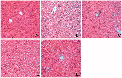 Figure 3. Histological examination of liver in HE staining. (A) Normal; (B) control diabetic; (C) diabetic + TGP 50 mg/kg; (D) diabetic + TGP 100 mg/kg; (E) diabetic + TGP 200 mg/kg. Original magnification 100×.